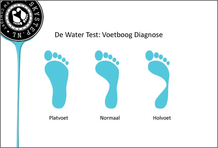 Holvoet - platvoet