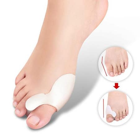 Hallux Valgus bescherming