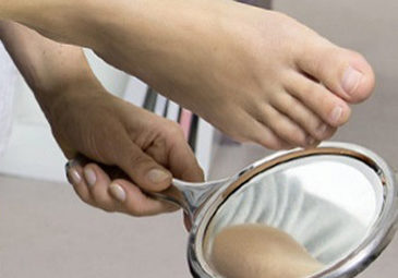 Diabetische voet Diabetische voet