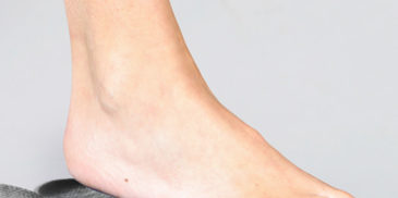 Inlegzooltjes Inlegzooltjes